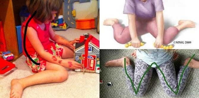 If your child is sitting in the “W” position, stop him right now!